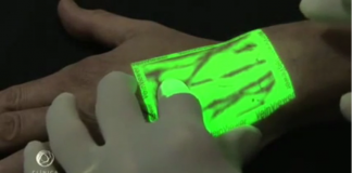 Equipamento evidencia as veias dos pacientes e diminui sofrimento Equipamento evidencia as veias dos pacientes e diminui sofrimento