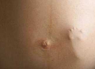 Que o bebê se mexe na barriga da mãe todo mundo sabe, mas uma filmagem assim vai te surpreender!