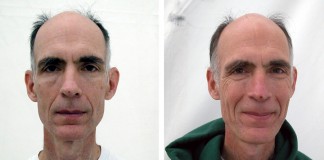 Os efeitos extraordinários da meditação no rosto humano