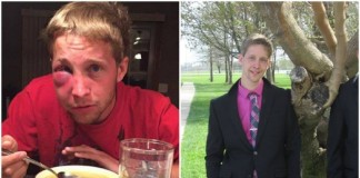 Adolescente com autismo é espancado por colegas e lhes dá uma grande lição de vida