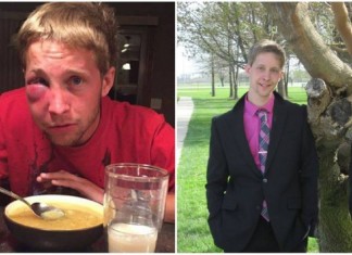 Adolescente com autismo é espancado por colegas e lhes dá uma grande lição de vida