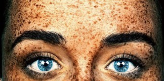 A beleza exótica das pessoas com sardas