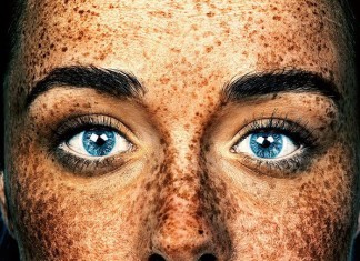 A beleza exótica das pessoas com sardas