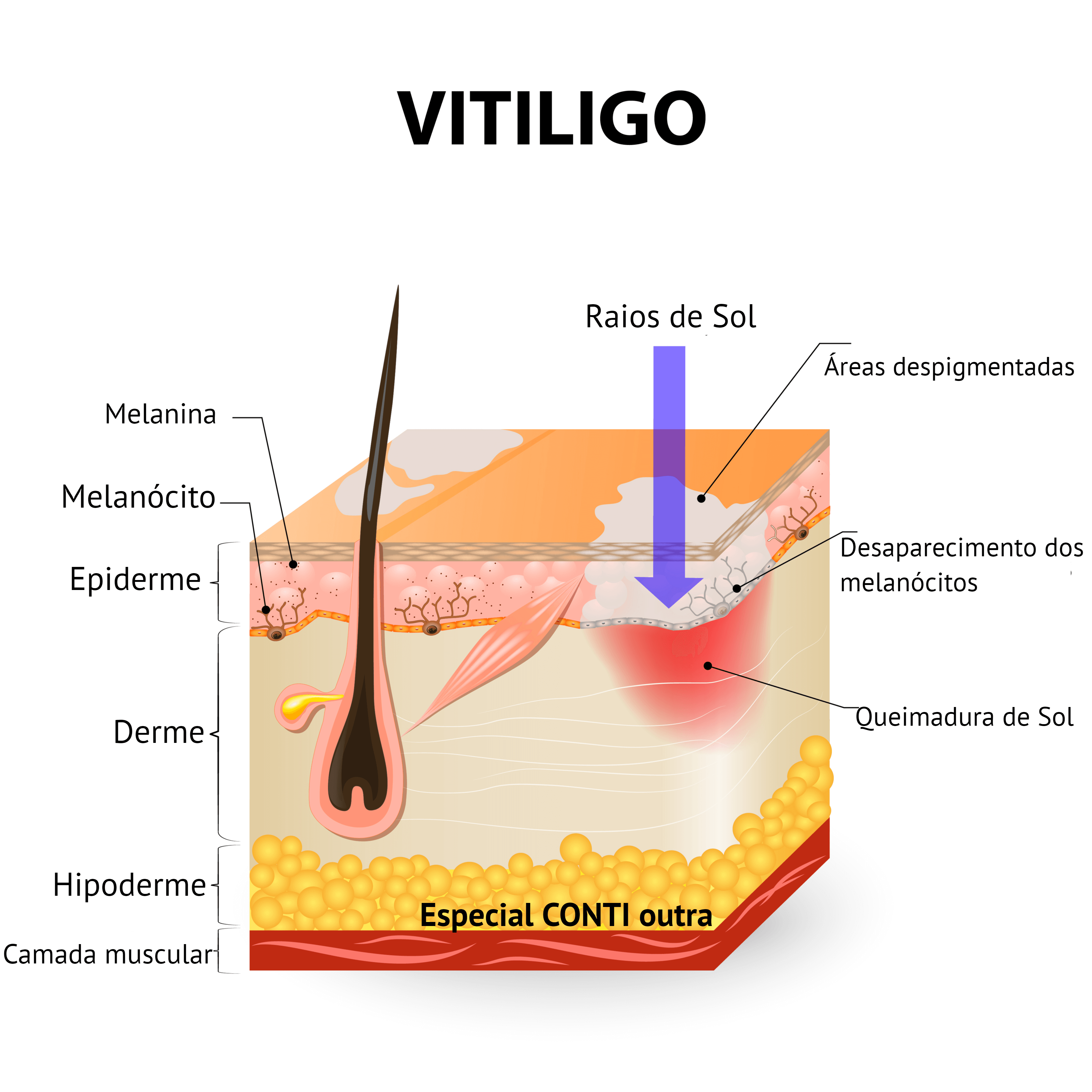 contioutra.com - Especial Vitiligo: o que sabemos da doença e do controverso tratamento cubano até o momento.