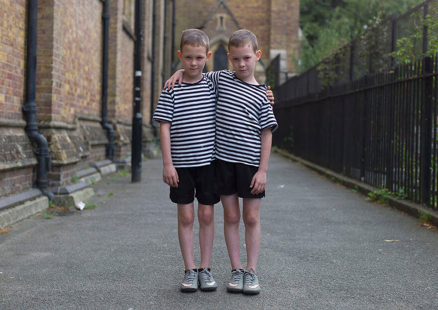 contioutra.com - Fotógrafo prova que gêmeos idênticos possuem diferenças sutis, mas perceptíveis