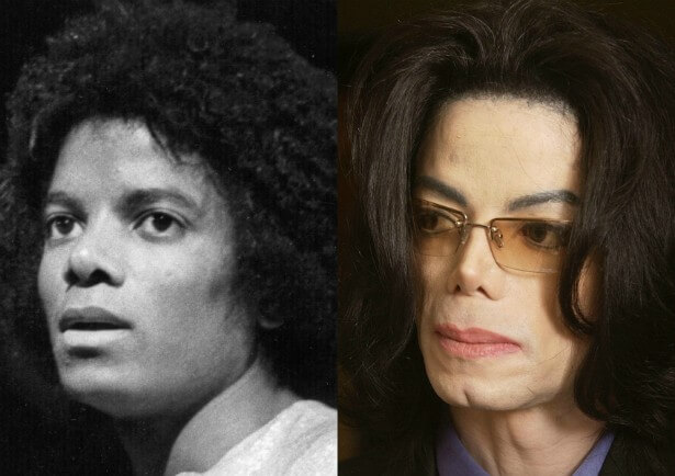 contioutra.com - Conheça as misteriosas semelhanças psicológicas entre o Ken Humano e Michael Jackson