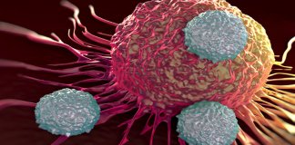 Pela primeira vez, câncer da mama é eliminado com imunoterapia