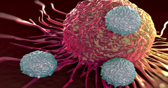Pela primeira vez, câncer da mama é eliminado com imunoterapia