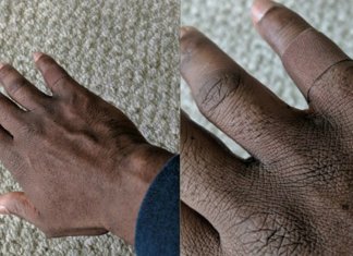 Homem encontra curativo do seu tom de pele e fica emocionado