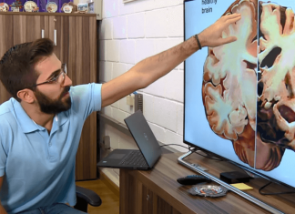 Universitários da Unicamp desenvolvem método inédito para diagnosticar Alzheimer