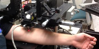 Laser destrói células cancerosas que circulam no sangue Laser destrói células cancerosas que circulam no sangue