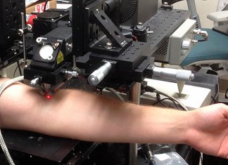 Laser destrói células cancerosas que circulam no sangue