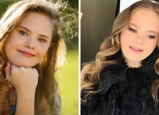 Modelo brasileira com Down é capa de revista australiana