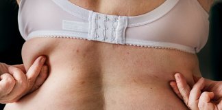 Depois dos 40, é mais saudável ser gordinha (ou gordinho)