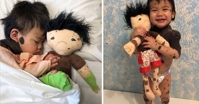 Artesã cria bonecos personalizados para crianças com deficiências e condições raras.