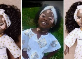 Bonecas com vitiligo ajudam crianças com mesma condição a gostarem de si mesmas