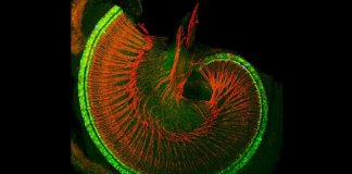 Pesquisadores descobrem maneira de restaurar danos auditivos e surdez irreversível Pesquisadores descobrem maneira de restaurar danos auditivos e surdez irreversível