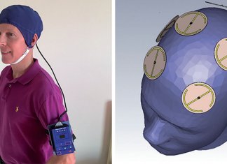 Cientistas revertem um ano de Alzheimer em dois meses através de nova invenção