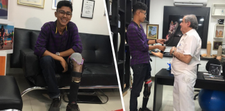 Jovem que fez ‘perna caseira’ com R$ 40 ganha prótese original
