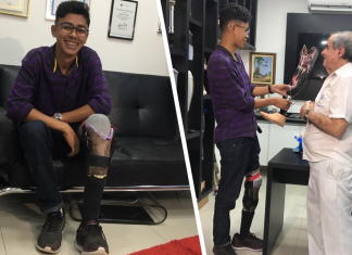 Jovem que fez ‘perna caseira’ com R$ 40 ganha prótese original