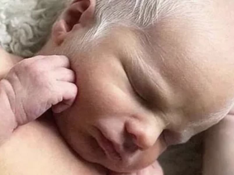 contioutra.com - Bebê albino é chamado de filho de Sugar Daddy e mãe decide promover conscientização sobre o albinismo