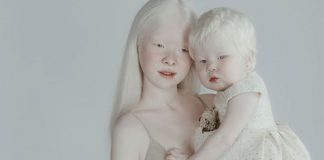 Ensaio deslumbrante de irmãs albinas mostra que a beleza existe nas mais diversas formas