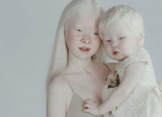 Ensaio deslumbrante de irmãs albinas mostra que a beleza existe nas mais diversas formas