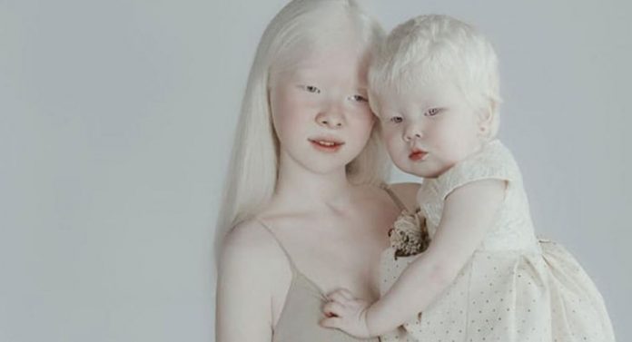 Ensaio deslumbrante de irmãs albinas mostra que a beleza existe nas mais diversas formas