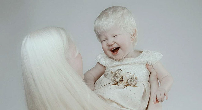 contioutra.com - Ensaio deslumbrante de irmãs albinas mostra que a beleza existe nas mais diversas formas