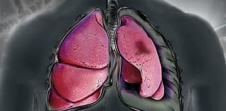 Terapia genética usa adenovírus modificado para reduzir em até 80% tumor de pulmão Terapia genética usa adenovírus modificado para reduzir em até 80% tumor de pulmão