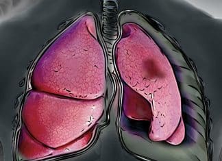 Terapia genética usa adenovírus modificado para reduzir em até 80% tumor de pulmão