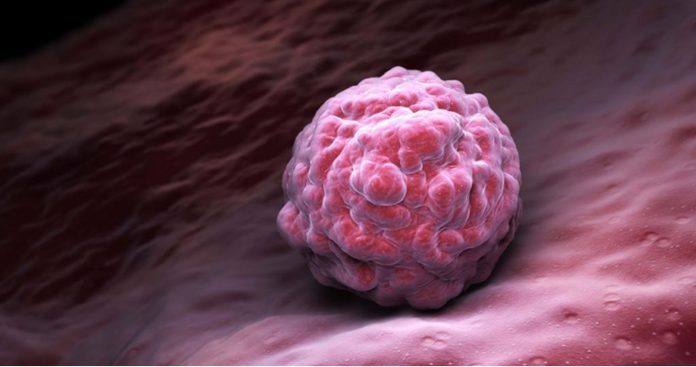 Biossensores que detectam câncer também poderão diagnosticar coronavírus