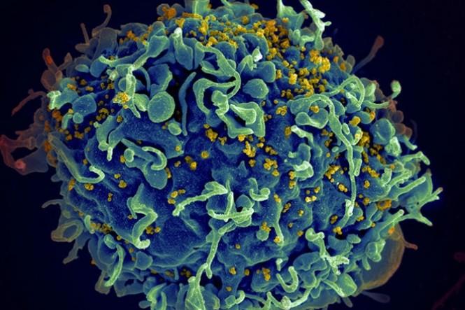 contioutra.com - Pesquisadores da Unifesp podem ter descoberto a cura do HIV