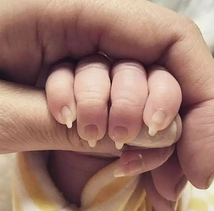 contioutra.com - Pais exibem com orgulho uma foto de sua bebê de dois meses com unhas compridas