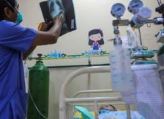 Criança de 3 anos diagnosticada com Covid sofre derrame e fica com parte do corpo paralisado