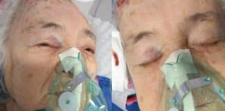 Hospital de Manaus é alvo de denuncia de negligência após idosa com Covid-9 cair de leito Hospital de Manaus é alvo de denuncia de negligência após idosa com Covid-9 cair de leito