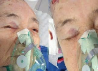 Hospital de Manaus é alvo de denuncia de negligência após idosa com Covid-9 cair de leito