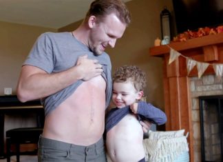 Ele doou seu fígado ao seu sobrinho e agora eles compartilham mais do que uma cicatriz