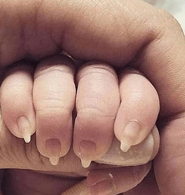 contioutra.com - Influenciadora &eacute; cancelada ap&oacute;s fazer unhas de gel em filha rec&eacute;m-nascida