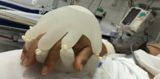 Técnica em enfermagem conforta paciente em isolamento usando luvas cheias de água morna