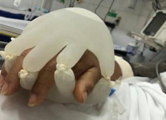 Técnica em enfermagem conforta paciente em isolamento usando luvas cheias de água morna