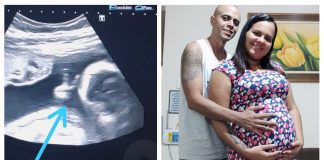 Bebê faz ‘V de vitória’ durante ultrassom e dá esperança a pai com câncer raro