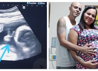Bebê faz ‘V de vitória’ durante ultrassom e dá esperança a pai com câncer raro