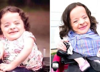 Mulher que foi rejeitada pelos médicos quando nasceu revela: “Vale a pena lutar pela vida”