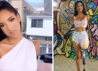 Sem três membros, influenciadora equatoriana é um exemplo de inclusão