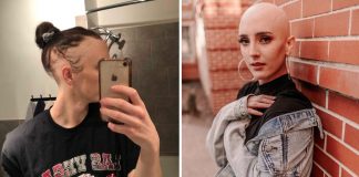 “Eu me sinto bonita”: jovem com alopecia deixa o medo para trás e raspa o cabelo completamente