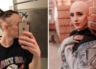 “Eu me sinto bonita”: jovem com alopecia deixa o medo para trás e raspa o cabelo completamente