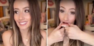 Influencer revela usar dentadura e surge com gengivas à mostra: “Não há motivo para vergonha”