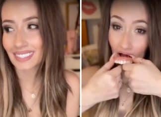 Influencer revela usar dentadura e surge com gengivas à mostra: “Não há motivo para vergonha”