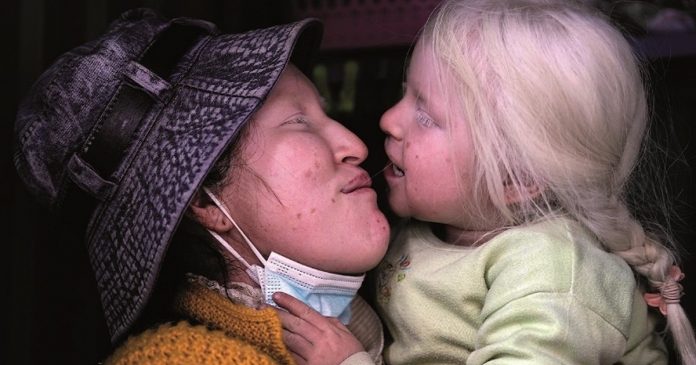Mãe deficiente visual criou a filha sozinha em um quiosque, enfrentando todas as dificuldades
